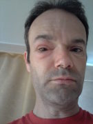 Quasimodo aka Laufmeister